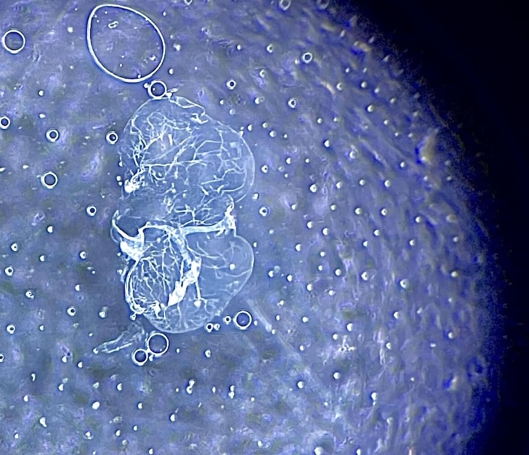 fly brain dissected by Anne